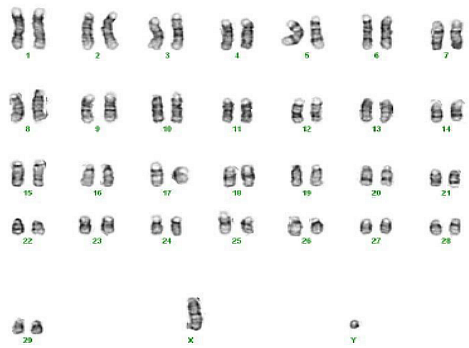 Chromosomensatz eines Ziegenbocks
